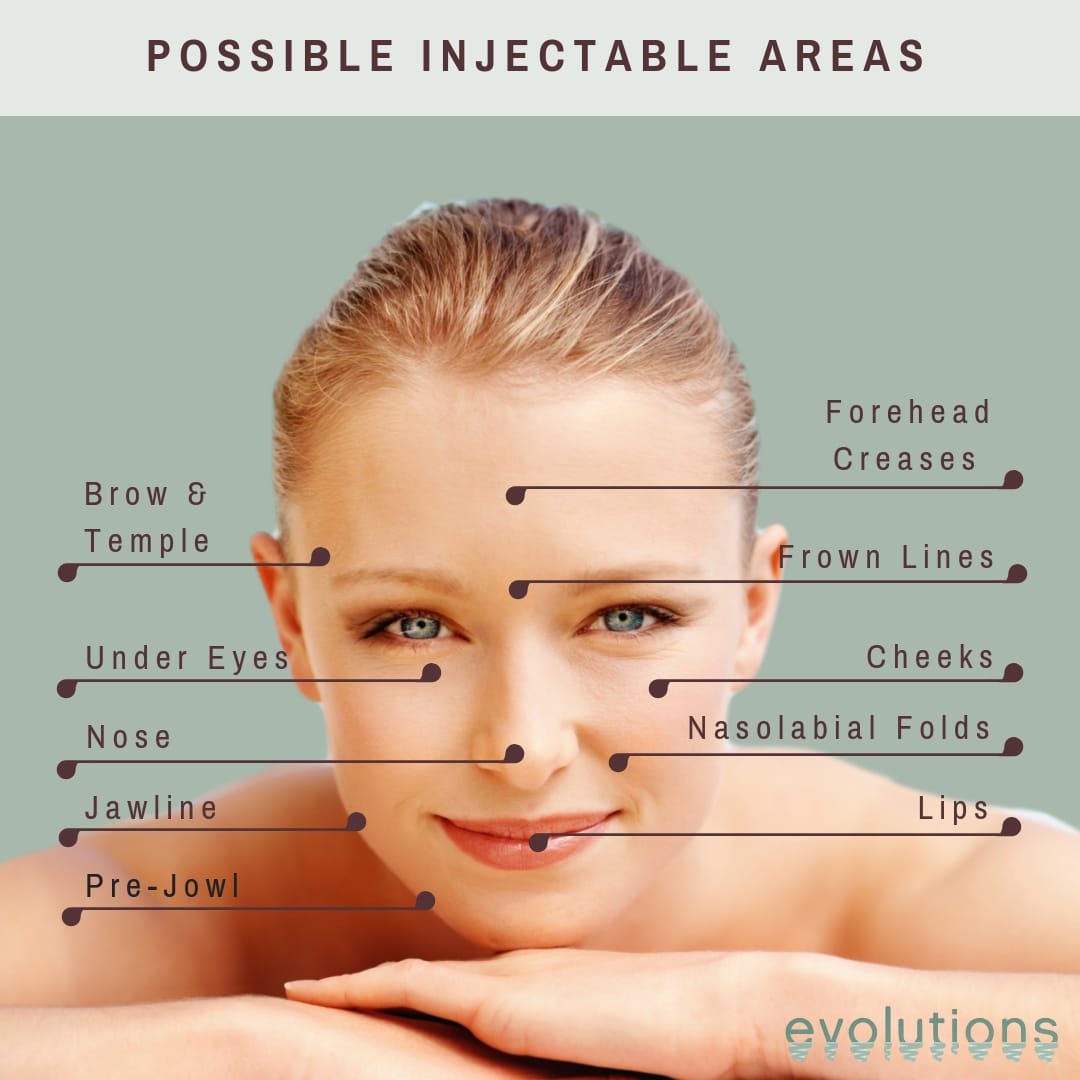 Evolutions Medical Spa Injectable Areas