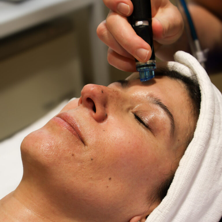 Hydrafacial Suzett Scaled E X