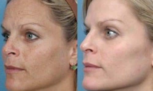 Testimonials Evolutions Medical And Day Spa In Santa Barbara Testimonials Evolutions Medical And Day Spa In Santa Barbara