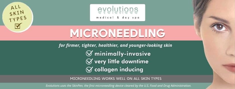 Microneedling Service in Santa Barbara or Collagen Induction Therapy from Evolutions Medical and Day Spa